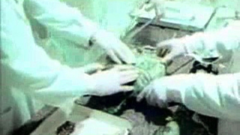 KGBs UFO  Alien Autopsy Leaked Footage